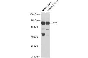 Western blot analysis of extracts of various cell lines, using BTD antibody (ABIN6127510, ABIN6137680, ABIN6137682 and ABIN6221882) at 1:1000 dilution. (BTD anticorps  (AA 284-543))