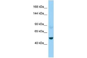 WB Suggested Anti-NEFM Antibody Titration: 1. (NEFM anticorps  (C-Term))