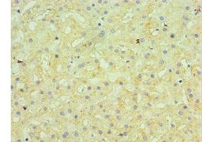 Immunohistochemistry of paraffin-embedded human liver tissue using ABIN7145506 at dilution of 1:100