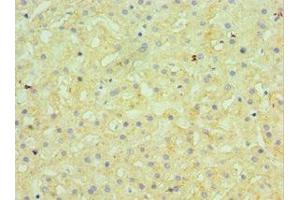 Immunohistochemistry of paraffin-embedded human liver tissue using ABIN7145506 at dilution of 1:100 (Glucuronidase beta anticorps  (AA 382-651))