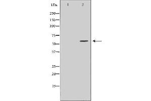 Western blot analysis of MCF7 cell lysate, using CDC25A Antibody. (CDC25A anticorps  (N-Term))