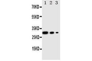Lane 3: Recombinant Human CRTC1 Protein 2. (CRTC1 anticorps  (C-Term))