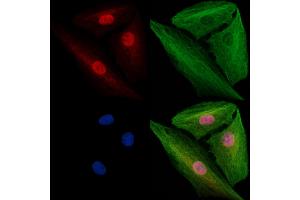 ABIN7094796 and ABIN7098847 staining  cells by IF/ICC. (SF3B1 anticorps  (N-Term))