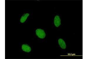 Immunofluorescence of purified MaxPab antibody to SAP30 on HeLa cell. (SAP30 anticorps  (AA 1-220))