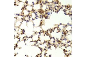 Immunohistochemistry of paraffin-embedded mouse lung using TAF1C Antibody. (TAF1C anticorps  (AA 70-320))