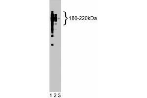 Western blot analysis of CD45 on a Jurkat cell lysate (Human T-cell leukemia, ATCC TIB-152). (CD45 anticorps  (AA 535-730))