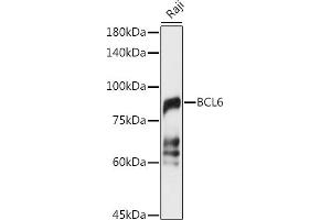 Western blot analysis of extracts of Raji cells, using BCL6 antibody (ABIN6130002, ABIN6137511, ABIN6137512 and ABIN6222987) at 1:1000 dilution. (BCL6 anticorps  (AA 1-280))
