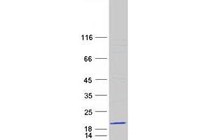 Validation with Western Blot