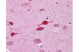 Immunohistochemistry (IHC) image for anti-Wingless-Type MMTV Integration Site Family, Member 5A (WNT5A) (Middle Region) antibody (ABIN2779470)