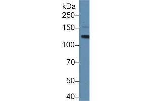 Western blot analysis of Mouse Serum, using Mouse LIFR Antibody (1 µg/ml) and HRP-conjugated Goat Anti-Rabbit antibody ( (LIFR anticorps  (AA 641-790))