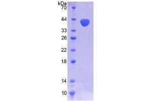 SDS-PAGE analysis of Human NOX5 Protein.