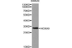 Western blot analysis of extracts of SW620 cell line, using HOXA9 antibody. (HOXA9 anticorps  (AA 1-190))