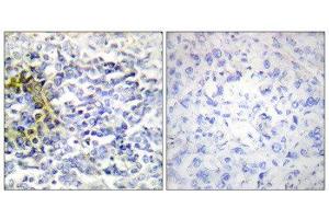 Immunohistochemistry (IHC) image for anti-Fragile X Mental Retardation, Autosomal Homolog 2 (FXR2) (C-Term) antibody (ABIN1849412) (FXR2 anticorps  (C-Term))