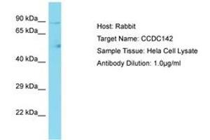 Image no. 1 for anti-Coiled-Coil Domain Containing 142 (CCDC142) (AA 658-707) antibody (ABIN6750704) (CCDC142 anticorps  (AA 658-707))
