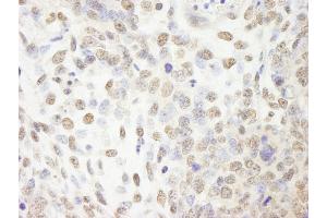 Immunohistochemistry (IHC) image for anti-Cleavage and Polyadenylation Specific Factor 2, 100kDa (CPSF2) (AA 450-500) antibody (ABIN7448485)