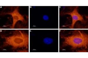Expression of Galanin receptor 1 in rat DRG - Immunocytochemical staining of GALR1 in a primary culture of rat dorsal root ganglion (DRG) neurons.