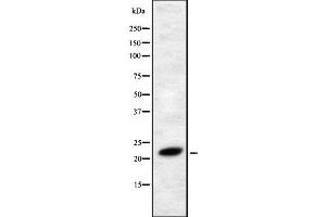 Western blot analysis FGF4 using RAW264. (FGF4 anticorps  (Internal Region))