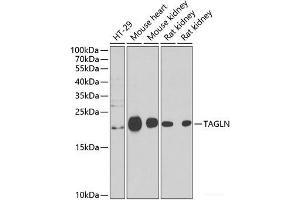 Western blot analysis of extracts of various cell lines using TAGLN Polyclonal Antibody at dilution of 1:1000. (Transgelin anticorps)