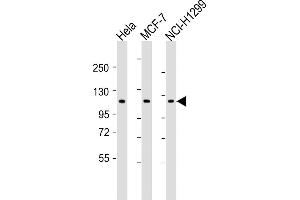 All lanes : Anti-P1R13L Antibody (Center) at 1:2000 dilution Lane 1: Hela whole cell lysates Lane 2: MCF-7 whole cell lysates Lane 3: NCI- whole cell lysates Lysates/proteins at 20 μg per lane.