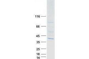 Validation with Western Blot