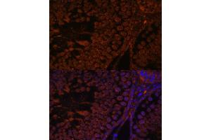 Immunofluorescence analysis of rat testis using TPD52L3 antibody (ABIN7271079) at dilution of 1:100. (TPD52L3 anticorps  (AA 1-132))