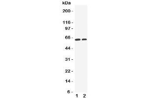 Western blot testing of OCT1 antibody and Lane 1:  HeLa;  2: A549 cell lysate. (SLC22A1 anticorps  (C-Term))