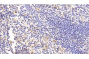 Detection of FCN1 in Mouse Spleen Tissue using Polyclonal Antibody to Ficolin 1 (FCN1)