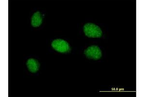 Immunofluorescence of purified MaxPab antibody to CDYL2 on HeLa cell. (CDYL2 anticorps  (AA 1-506))