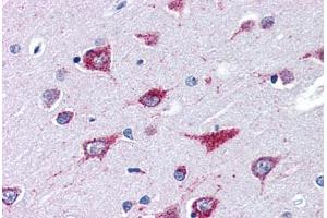 Human Brain, Cortex (formalin-fixed, paraffin-embedded) stained with ALS2 antibody ABIN351462 at 3. (ALS2 anticorps  (AA 1644-1657))