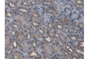 DAB staining on IHC-P; Samples: Rat Kidney Tissue