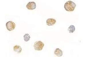 Immunocytochemistry of BICD1 in Daudi cells with AP30144PU-N BICD1 antibody at 2.