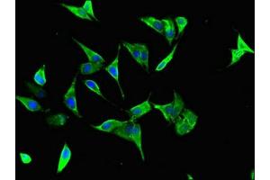 Immunofluorescent analysis of Hela cells using ABIN7155909 at dilution of 1:100 and Alexa Fluor 488-congugated AffiniPure Goat Anti-Rabbit IgG(H+L)