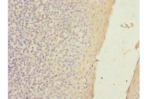 Immunohistochemistry of paraffin-embedded human tonsil tissue using ABIN7170174 at dilution of 1:100 (SLC23A2 anticorps  (AA 1-90))