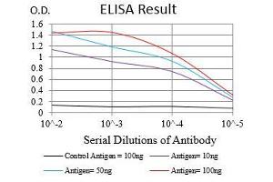 Black line: Control Antigen (100 ng), Purple line: Antigen(10 ng), Blue line: Antigen (50 ng), Red line: Antigen (100 ng),