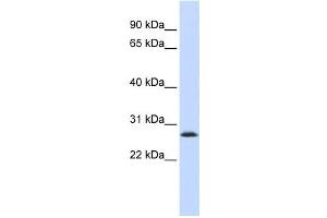Western Blotting (WB) image for anti-LSM12 Homolog B (LSM12B) antibody (ABIN2459597)