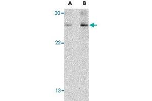 Western blot analysis of TSLP in Jurkat cell lysate with TSLP polyclonal antibody  at (A) 1 and (B) 2 ug/mL . (Thymic Stromal Lymphopoietin anticorps  (C-Term))