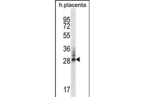 DNAJC27 Antibody (N-term) (ABIN656683 and ABIN2845921) western blot analysis in human placenta tissue lysates (35 μg/lane).