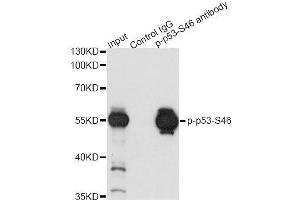 Immunoprecipitation analysis of 200 μg extracts of 293 cells both treated by UV and serum using 2. (p53 anticorps  (pSer46))