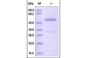 Human Serpin H1, His Tag on SDS-PAGE under reducing (R) condition. (SERPINH1 Protein (AA 19-418) (His tag))