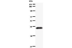 Western Blotting (WB) image for anti-Zw10 Kinetochore Protein (ZW10) antibody (ABIN933128) (ZW10 anticorps)