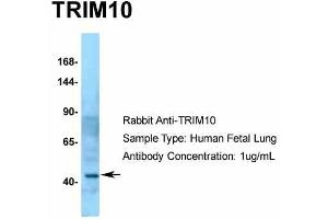 Host:  Rabbit  Target Name:  TRIM10  Sample Type:  Human Fetal Lung  Antibody Dilution:  1. (TRIM10 anticorps  (C-Term))