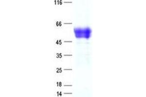 Validation with Western Blot