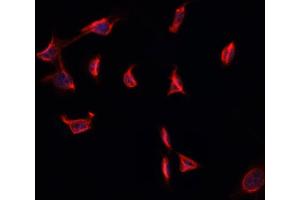 ABIN6274001 staining HepG2 cells by ICC/IF. (CD11b anticorps  (Internal Region))