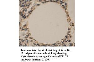 Image no. 1 for anti-Aldo-Keto Reductase Family 1, Member C3 (3-alpha Hydroxysteroid Dehydrogenase, Type II) (AKR1C3) antibody (ABIN1574574)