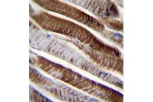 Formalin fixed and paraffin embedded human skeletal muscle reacted with ETFA Antibody (C-term) followed by peroxidase conjugation of the secondary antibody and DAB staining. (ETFA anticorps  (C-Term))