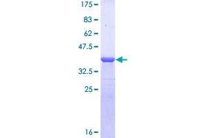 Image no. 1 for Cyclin D Binding Myb-Like Transcription Factor 1 (DMTF1) (AA 221-330) protein (GST tag) (ABIN1351721)