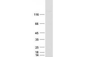 Validation with Western Blot