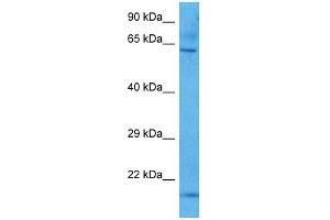 Host:  Mouse  Target Name:  KCNQ1  Sample Tissue:  Mouse Brain  Antibody Dilution:  1ug/ml (KCNQ1 anticorps  (N-Term))