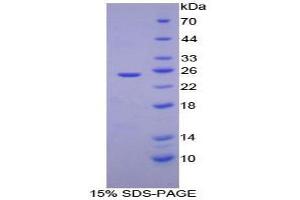 SDS-PAGE analysis of Mouse ADH1 Protein. (ADH1 Protéine)