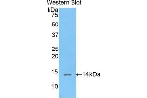 Detection of Recombinant Corin, Rat using Polyclonal Antibody to Corin (CRN)